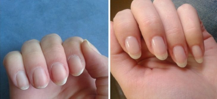 Быстро отрастить ногти, которые не поломаются, теперь легче простого!