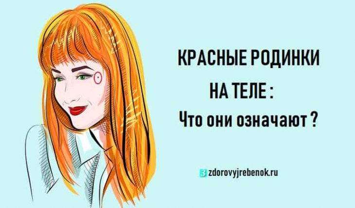 КРАСНЫЕ РОДИНКИ на теле: Что они означают ?