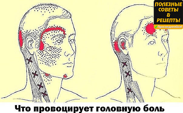 Забыть о головных болях, улучшить кровообращение головного мозга поможет мощное средство из 4 ингредиентов!