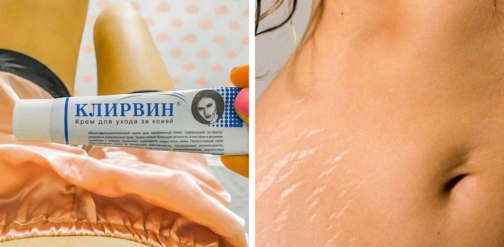 Дешёвые средства из аптеки, которые работают не хуже дорогой косметики Дешёвые средства из аптеки, которые работают не хуже дорогой косметики