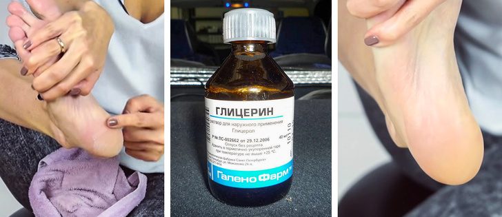 Дешёвые средства из аптеки, которые работают не хуже дорогой косметики Дешёвые средства из аптеки, которые работают не хуже дорогой косметики