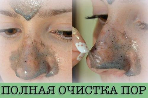 Девочки! Кроме шуток, эта штука вычищает все черные точки, угри и сыпи. Просто потрясающий рецептик!