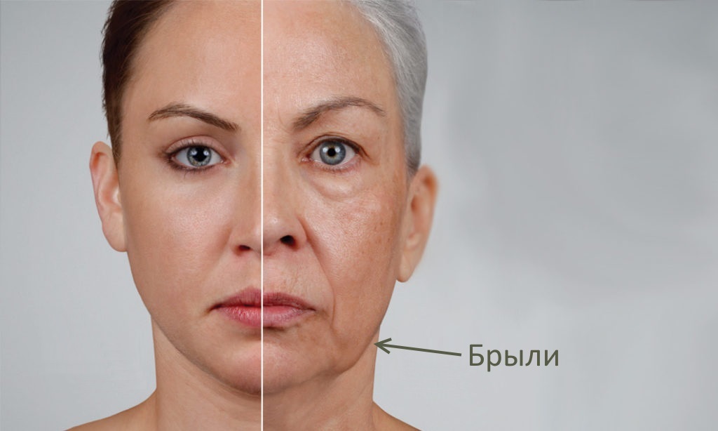 Как убрать брыли на щеках — самые эффективные методы