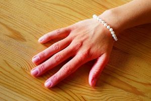 9 опасных заболеваний, о которых сигнализируют руки. Присмотрись внимательнее 9 опасных заболеваний, о которых сигнализируют руки. Присмотрись внимательнее