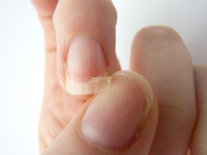 9 опасных заболеваний, о которых сигнализируют руки. Присмотрись внимательнее 9 опасных заболеваний, о которых сигнализируют руки. Присмотрись внимательнее