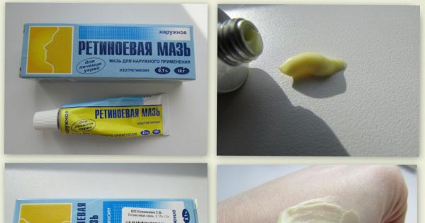 Копеечные средства для вашей красоты из аптеки! Обычная косметика в долю не падает…