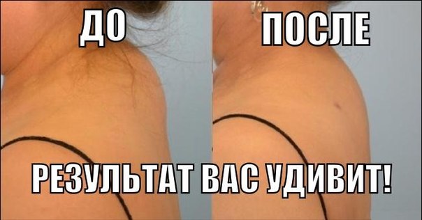 КАК ИЗБАВИТЬСЯ ОТ ХОЛКИ НА ШЕЕ! После нескольких процедур шея вновь станет гибкой и красивой!