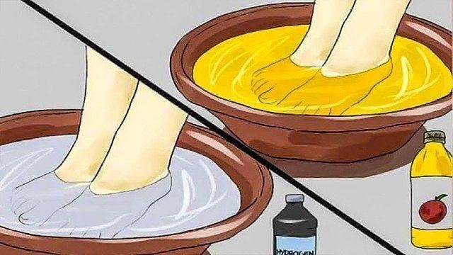 14 способов использовать яблочный уксус.