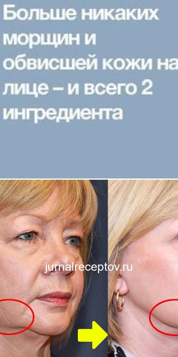 БОЛЬШЕ НИКАКИХ МОРЩИН И ОБВИСШЕЙ КОЖИ НА ЛИЦЕ – И ВСЕГО 2 ИНГРЕДИЕНТА !