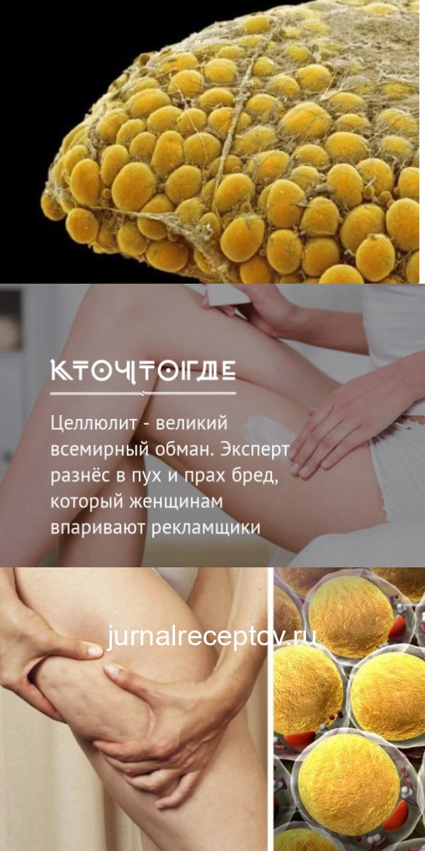 Целлюлит — великий всемирный обман. Эксперт разнёс в пух и прах бред, который женщинам впаривают рекламщики Целлюлит — великий всемирный обман. Эксперт разнёс в пух и прах бред, который женщинам впаривают рекламщики