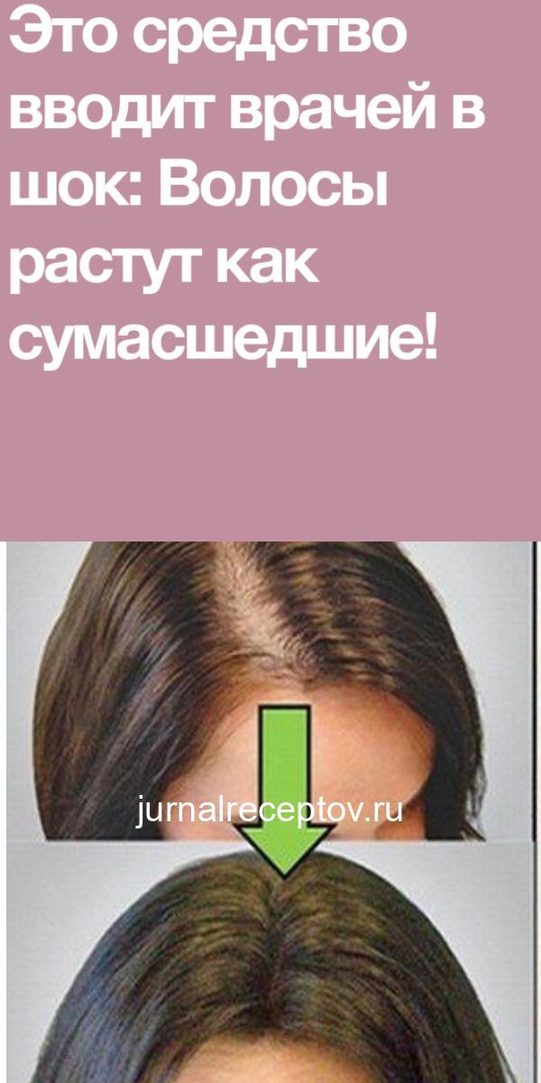 ЭТО СРЕДСТВО ВВОДИТ ВРАЧЕЙ В ШОК: ВОЛОСЫ РАСТУТ КАК СУМАСШЕДШИЕ! ЭТО СРЕДСТВО ВВОДИТ ВРАЧЕЙ В ШОК: ВОЛОСЫ РАСТУТ КАК СУМАСШЕДШИЕ!