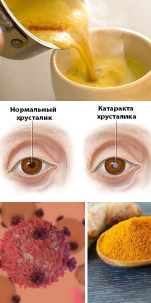 ИЗБАВЬСЯ ОТ КАТАРАКТЫ, ДИАБЕТА, ВОСПАЛЕНИЯ, АРТРИТА, ТРОМБОЗА И НЕ ТОЛЬКО! ВЫПЕЙ 1 СТАКАН ЭТОГО НАПИТКА ПЕРЕД СНОМ! ИЗБАВЬСЯ ОТ КАТАРАКТЫ, ДИАБЕТА, ВОСПАЛЕНИЯ, АРТРИТА, ТРОМБОЗА И НЕ ТОЛЬКО! ВЫПЕЙ 1 СТАКАН ЭТОГО НАПИТКА ПЕРЕД СНОМ!