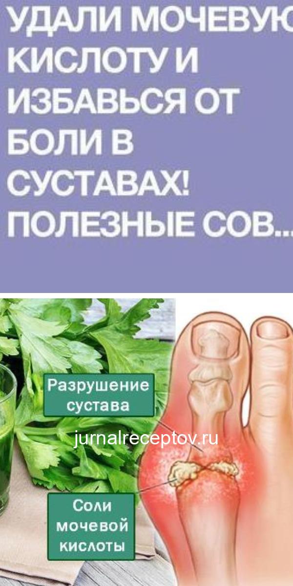УДАЛИ МОЧЕВУЮ КИСЛОТУ И ИЗБАВЬСЯ ОТ БОЛИ В СУСТАВАХ!