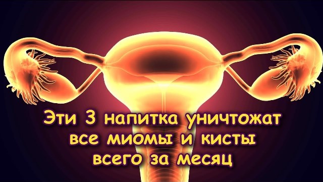 3 напитка которые уничтожат все миомы и кисты всего за месяц!