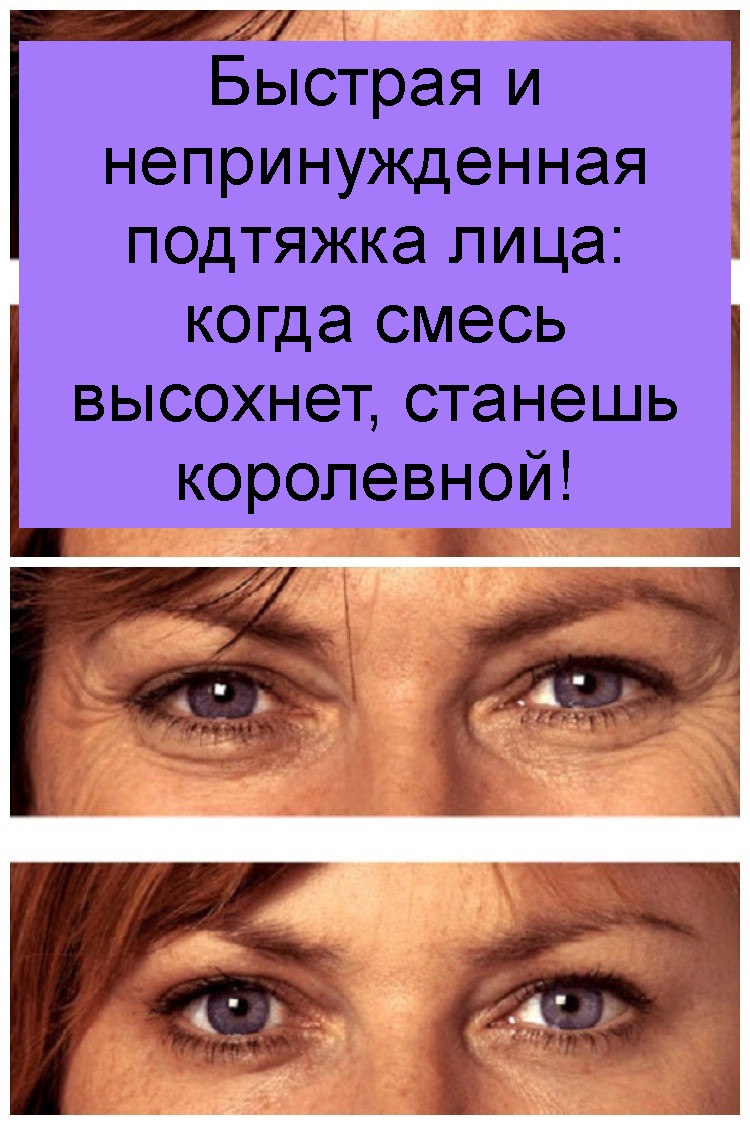 Быстрая и непринужденная подтяжка лица: когда смесь высохнет, станешь королевной! Быстрая и непринужденная подтяжка лица: когда смесь высохнет, станешь королевной 4
