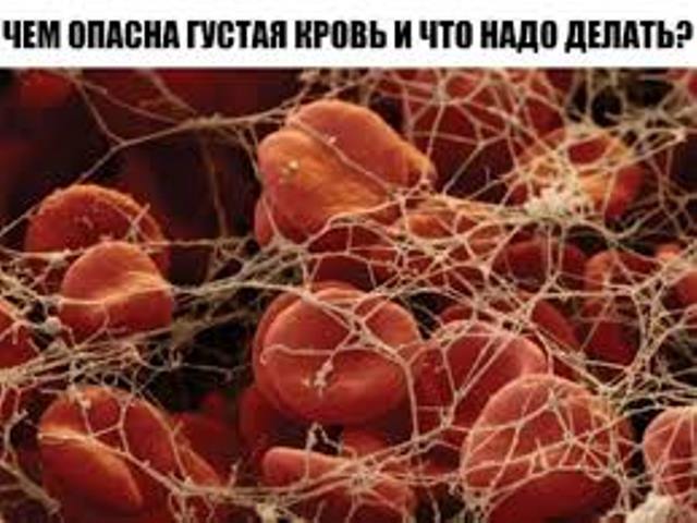 ЧЕМ ОПАСНА ГУСТАЯ КРОВЬ И ЧТО НАДО ДЕЛАТЬ?