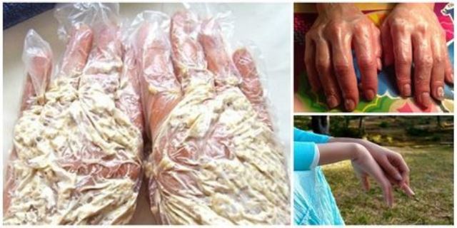Чудо-маска от трещин на руках (с омолаживающим эффектом) кожа рук становится мягкой, эластичной и трещины проходят буквально за 3-4 дня