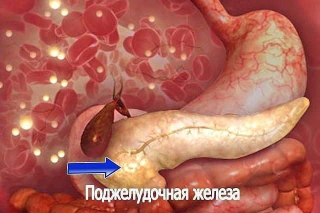 ЕСЛИ ПОДЖЕЛУДОЧНАЯ СТРАДАЕТ - РЕЦЕПТ С МГНОВЕННЫМ ДЕЙСТВИЕМ.