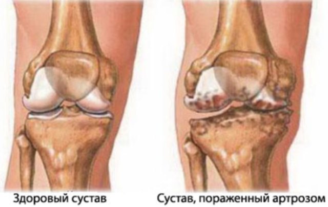 Этот простой и вкусный домашний напиток вернет молодость вашим суставам
