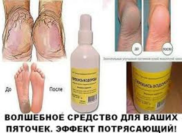 Моментальный эффект! Волшебное средство для ваших пяточек.