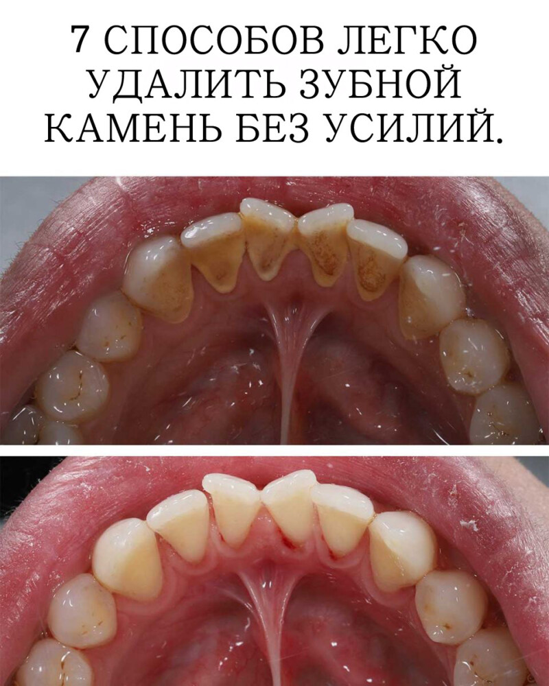 7 советов: здоровая улыбка без стоматолога