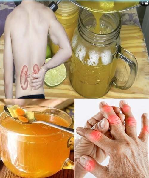 Чай с куркумой: секретный рецепт очищения почек, украшения кожи и улучшения 10 состояний здоровья