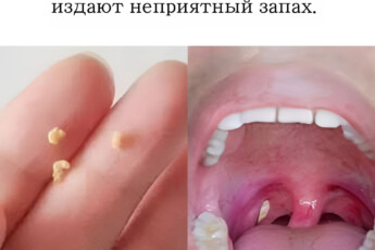 Мы объясняем, что это такое и как это исправить