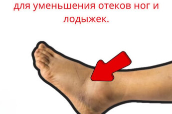 Попрощайтесь с отечностью стоп и лодыжек!