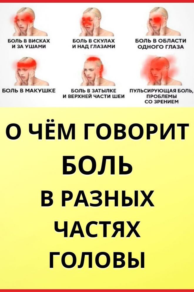 Виды головной боли и их причины: не потеряйте эту шпаргалку.