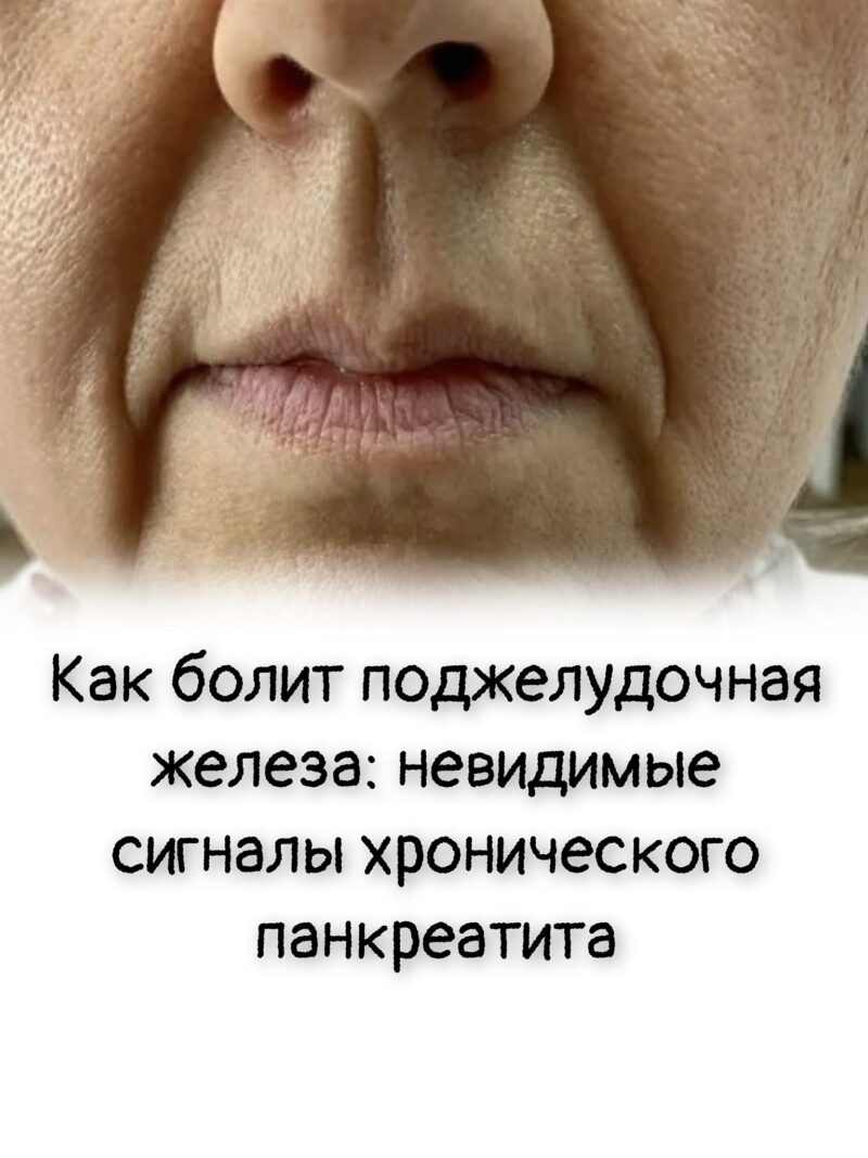 Как болит поджелудочная железа: невидимые сигналы хронического панкреатита