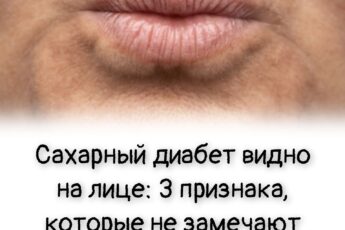 Сахарный диабет видно на лице: 3 признака, которые не замечают люди пожилого возраста
