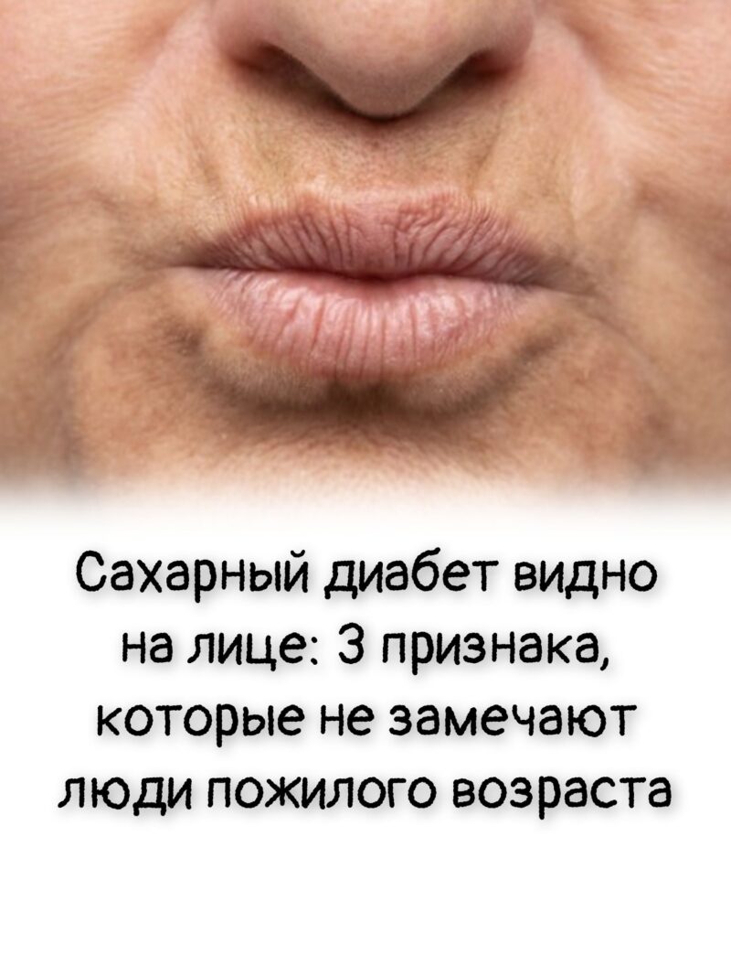 Сахарный диабет видно на лице: 3 признака, которые не замечают люди пожилого возраста