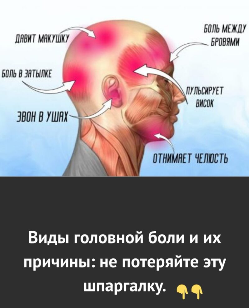 Виды головной боли и их причины: не потеряйте эту шпаргалку. 