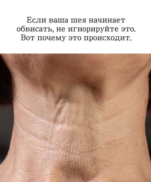 «Обвисшая шея — сигнал, который нельзя пропустить. Узнайте, что происходит с вашей кожей» «Обвисшая шея — сигнал, который нельзя пропустить. Узнайте, что происходит с вашей кожей»