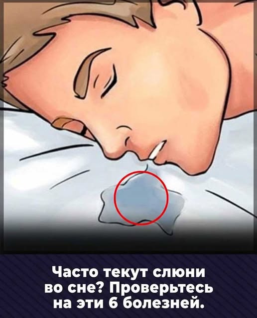 Просыпаетесь с мокрой подушкой? Узнайте причины слюнотечения во сне, когда это норма и какие симптомы требуют срочного обращения к врачу! 