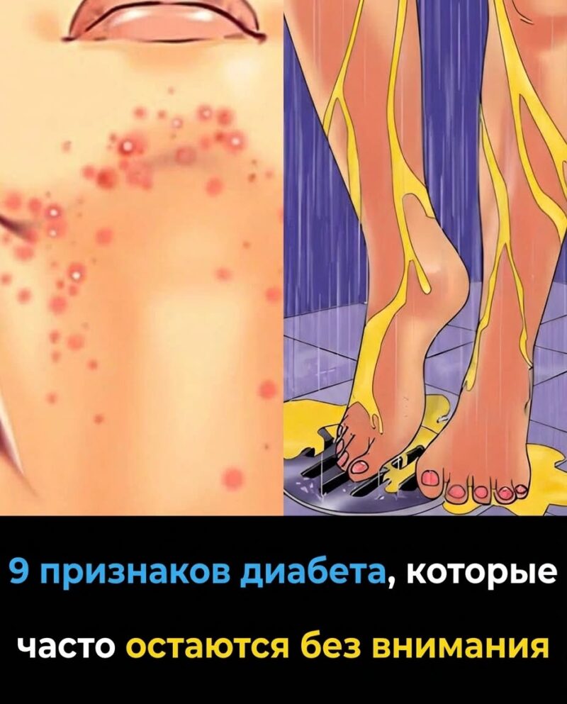 9 тревожных признаков диабета, которые нельзя оставлять без внимания. 9 тревожных признаков диабета, которые нельзя оставлять без внимания.