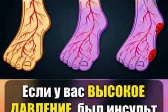 Сталкиваетесь с проблемами артериального давления или вен? Попробуйте эти 5 жизненно важных привычек прямо сейчас!