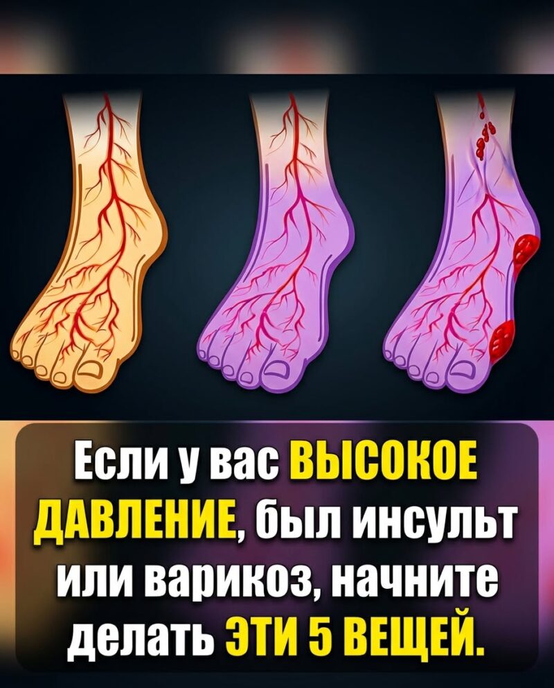 Сталкиваетесь с проблемами артериального давления или вен? Попробуйте эти 5 жизненно важных привычек прямо сейчас!