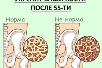 Не творог: Вот что реально укрепит ваши кости после 55-ти