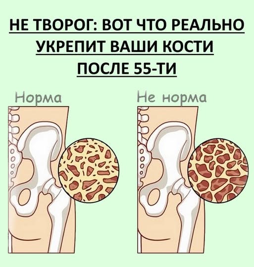 Не творог: Вот что реально укрепит ваши кости после 55-ти